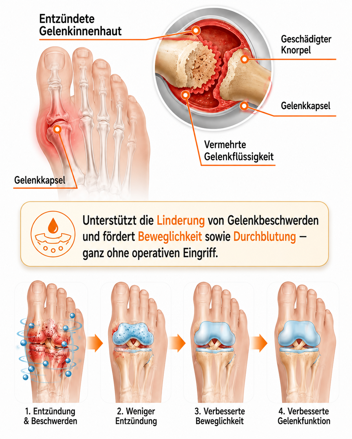 🏅 Natravor® Patch botanique confort pour hallux valgus 👠 Soin des pieds flexible + formule de confort d’inspiration végétale