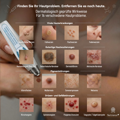 Offizieller Markenstore |✅Natravor® 7-𝑻𝒂𝒈𝒆 𝑯𝒂𝒖𝒕𝒂𝒏𝒉ä𝒏𝒈𝒔𝒆𝒍- & 𝑭𝒍𝒆𝒄𝒌𝒆𝒏𝒆𝒏𝒕𝒇𝒆𝒓𝒏𝒆𝒓(Schmerzfreier Rollerball – Keine Narbenbildung)🚀